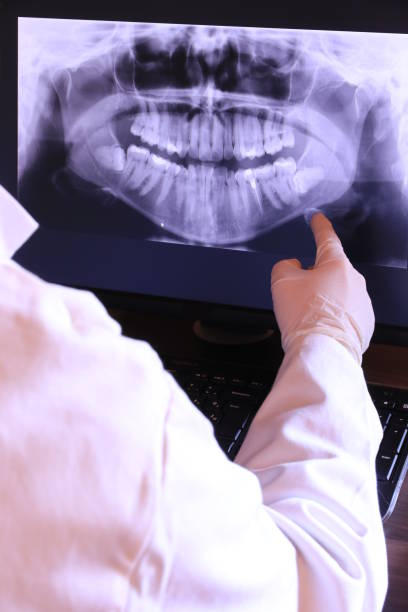 Best Broken Tooth Emergency  in Cedarville, OH