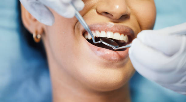 Best Knocked-Out Tooth Emergency  in Cedarville, OH