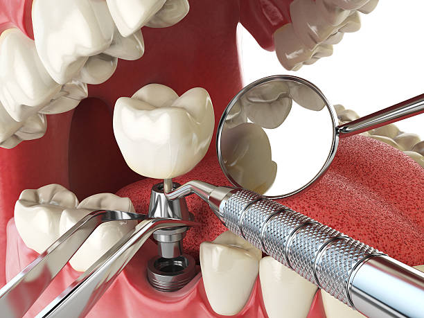 Best Tooth Pain Emergency Relief  in Cedarville, OH